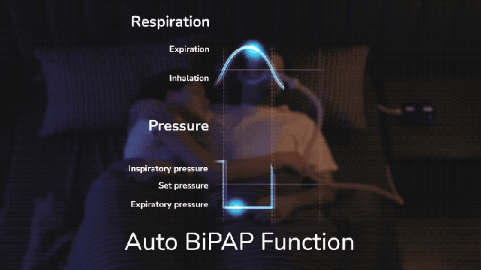 Mini Bluetooth CPAP anti-snoring device