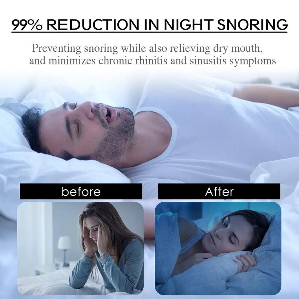 Stop Snoring Patch with Nose Breathing Correction