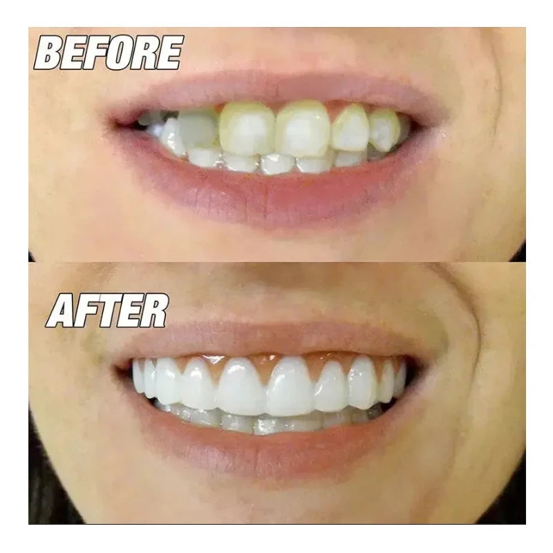 Dentures Face Makeup Teeth Stickers – Realistic Orthodontic Simulation